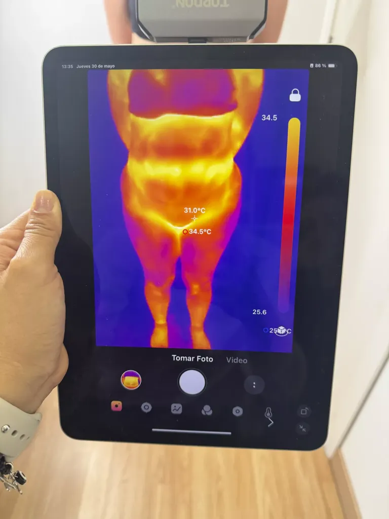 Pantalla de diagnostico con cámara termográfica