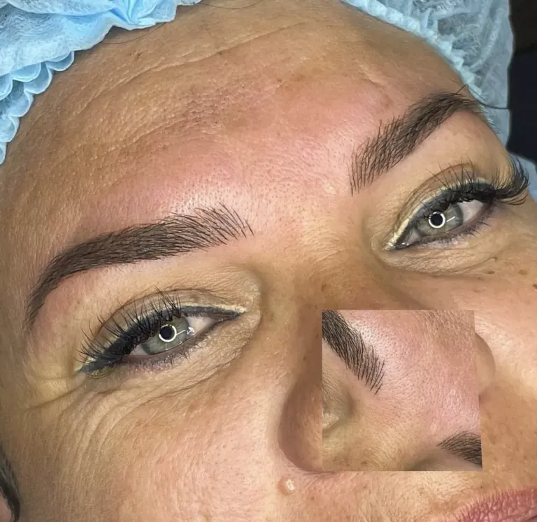 Ejemplo de tratamiento de fusion brows